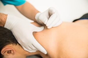 طب سوزنی در شانه منجمد