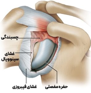 آناتومی شانه منجمد