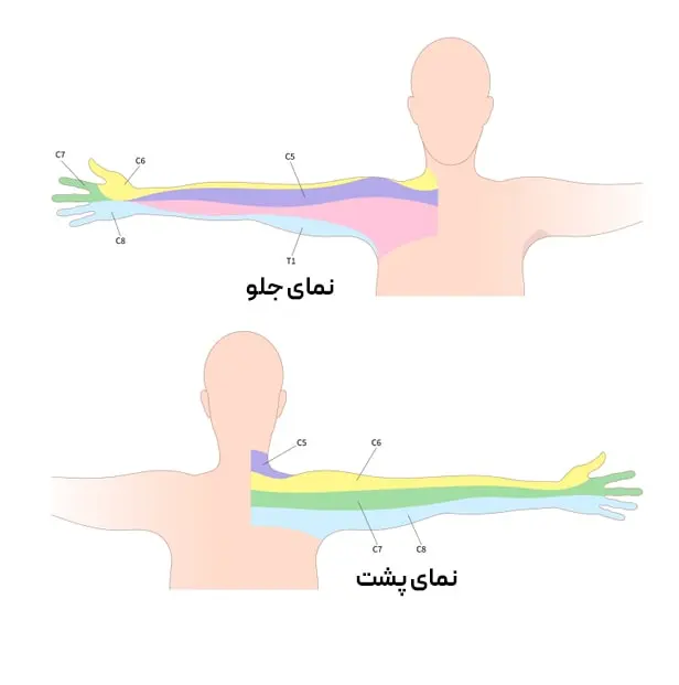 دیسک گردنی بر حسب محل فتق