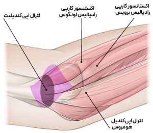 پاتوفیزیولوژی تنیس آلبو