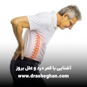 علل-بروز-کمر-درد-چیست؟